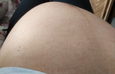 resimli 34 hafta bebegin toplanmasi hamilelik donemi genel